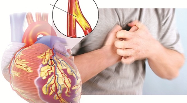 Giấc ngủ ảnh hưởng thế nào tới trái tim của bạn?