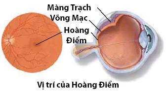 Thoái hóa điểm vàng đang trẻ hóa