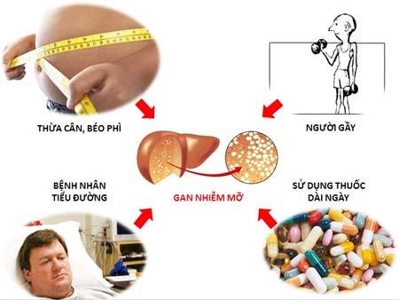 Không nên quá lo lắng khi kết quả siêu âm là gan nhiễm mỡ