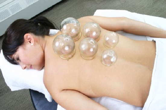 Một số điều có thể bạn chưa biết về giác hơi