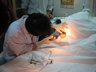 Những dấu hiệu của bệnh trĩ