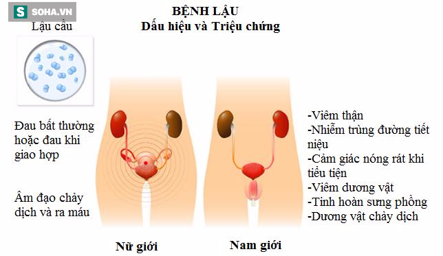 bệnh lậu bệnh lậu