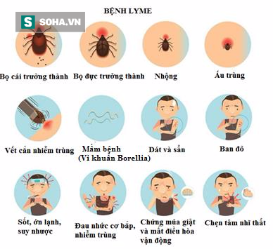 bệnh lyme bệnh lyme