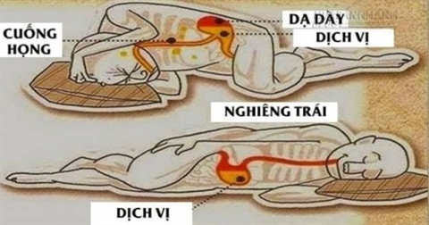 ngủ nghiêng bên trái