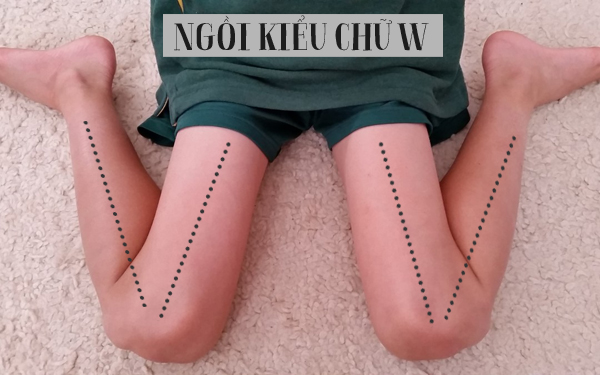 ngồi dạng chữ W ngồi dạng chữ W