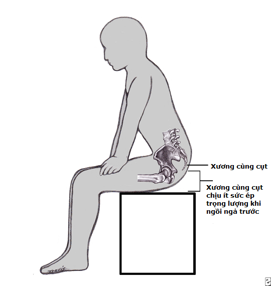 Cẩn thận chấn thương xương cụt do bị ngã hoặc tai nạn