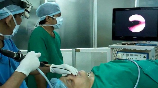 nội soi dạ dày nội soi dạ dày