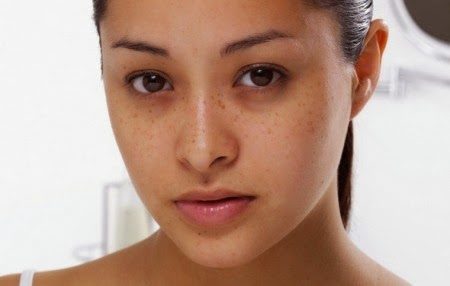 Vì sao bạn ngủ đủ mà mắt vẫn có quầng thâm?