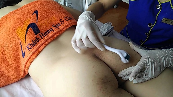 Bí quyết để mông không bị thâm cho dân văn phòng