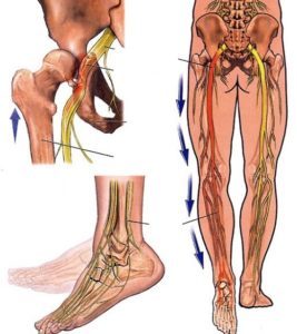 Dây thần kinh tọa nằm ở đâu?