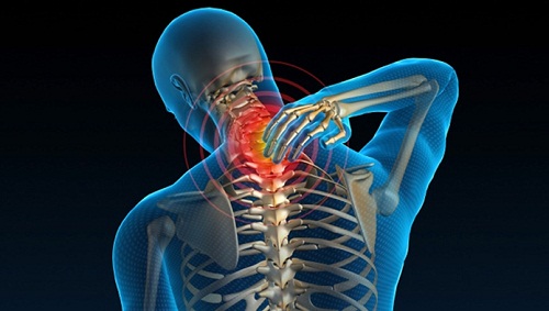 Chữa thoái hóa đốt sống cổ
