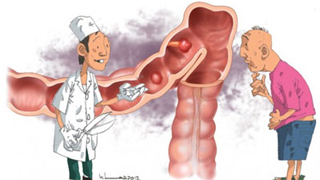 viêm trực tràng viêm trực tràng